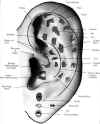 Ear2.JPG (77981 bytes)